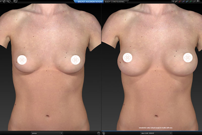 Dr. Lona Raab 3D Animation Brust